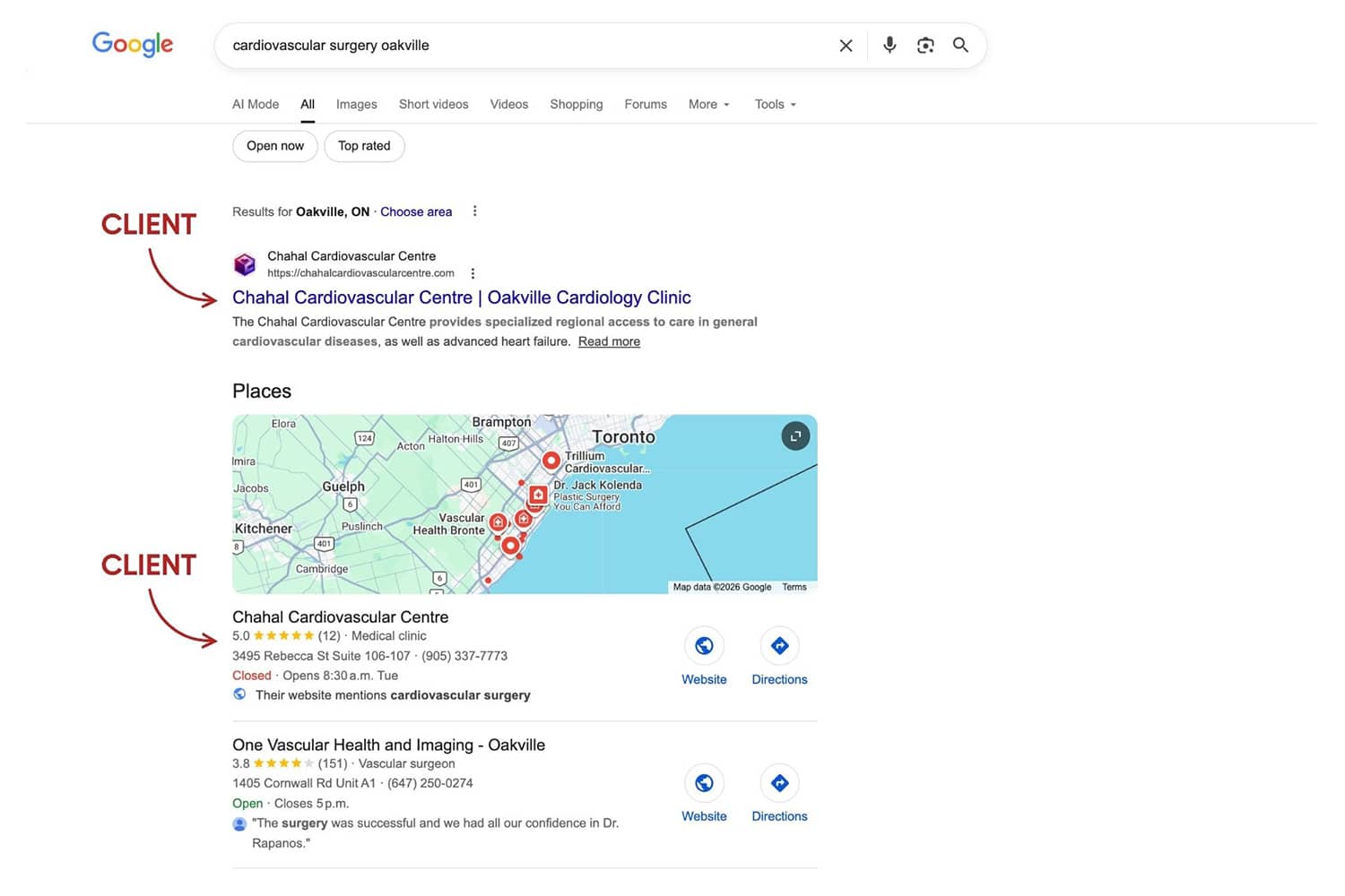 Screenshot of Chahal Cardiovascular Centre ranking #1 on Google for the query "cardiovascular surgery oakville"